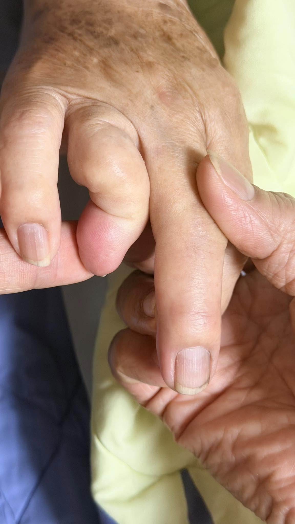 blog-thumb-naile